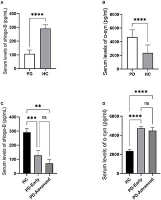 Decreased soluble Nogo-B in serum as a promising biomarker for Parkinson's disease